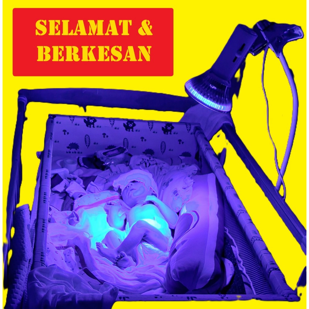 Jaundice Phototherapy LED Blue Light Lamp Home Use with EYE MASK