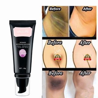 Check Out Private Parts Skin Whitening Cream Underarm Knee Dark Spot  Corrector Niacinamide Collagen Skin Care Thigh Gap Cream Brightening  Moistening And Shrinking Pores @ Best Price Online