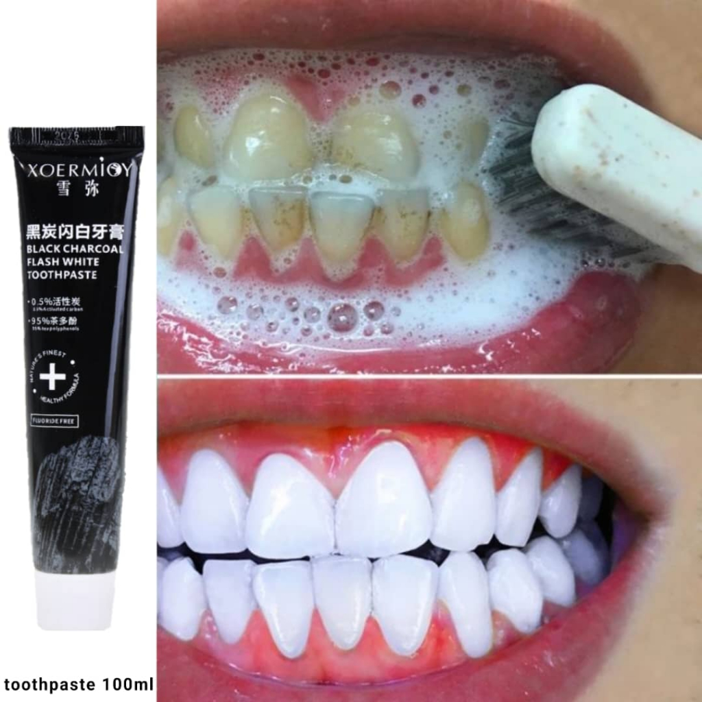 【竹炭牙膏】Bamboo Charcoal Whitening Toothpaste/ Ubat Gigi/竹炭美白牙膏/Removes ...