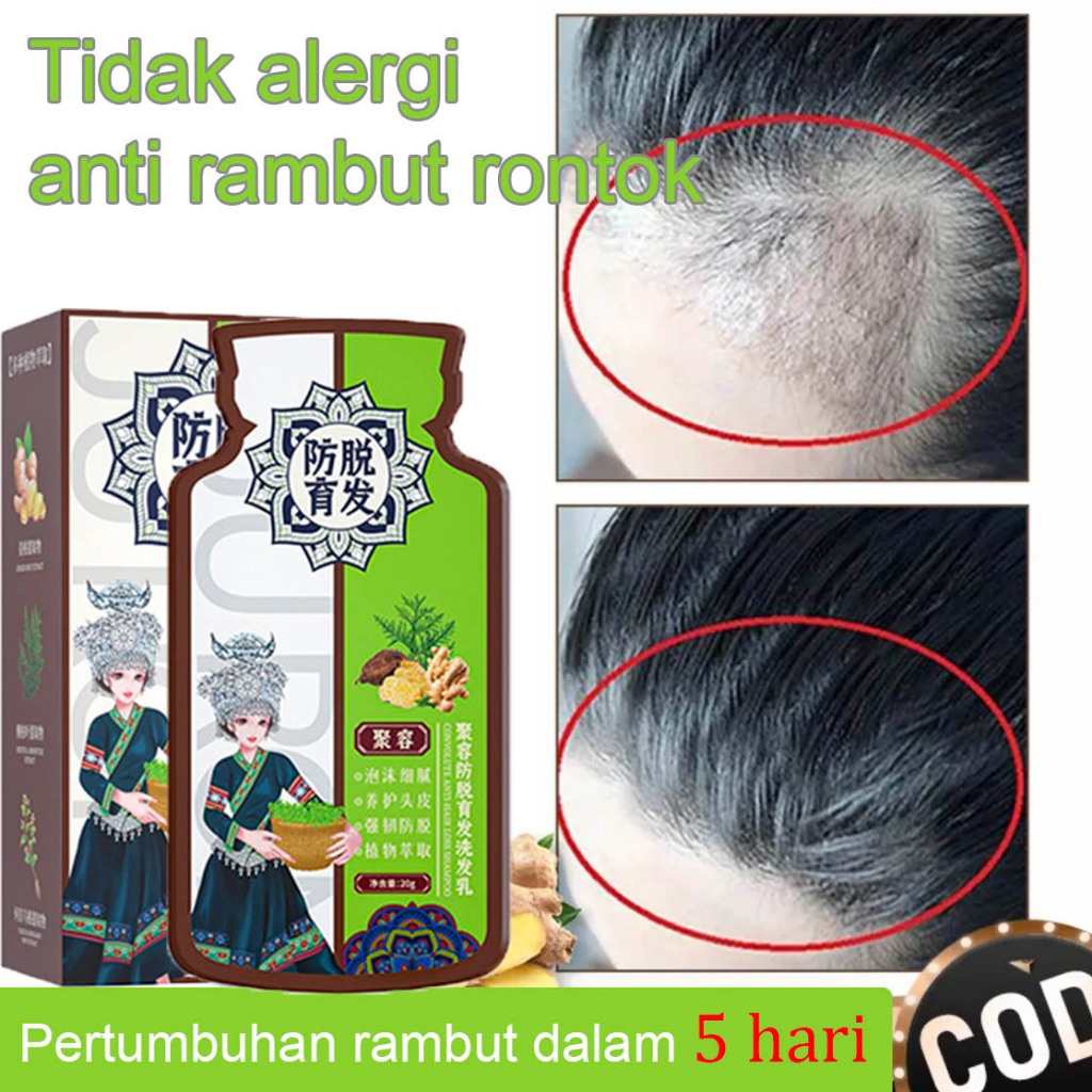 Hair Growth Ginger shampoo rambut gugur hair fall lebatkan rambut hair ...