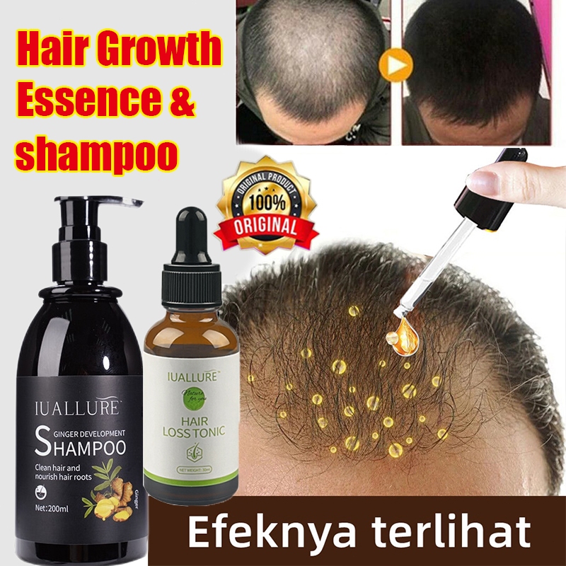 minyak rambut cepat panjang hair loss tonic for hair growth hair fall ...