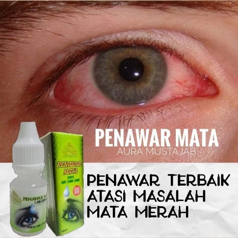 OFFER‼️ (POST TODAY) 💯 Original Penawar Mata | Ubat Titis Mata Aura ...