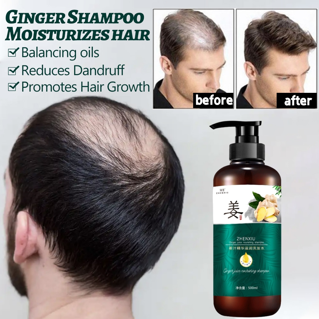 Ginger Shampoo Moisturizes hair roots Anti-dandruff oil Control ...