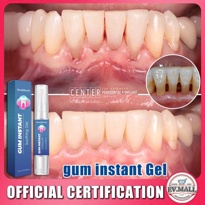 Gum Instant Soothing Gel Newteeth Repairing Tooth Powder Receding Gums