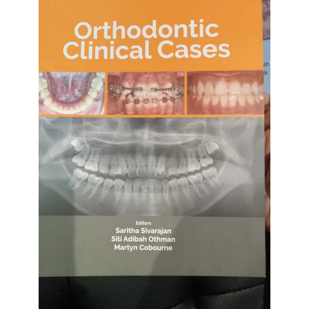(UM) ORTHODONTIC CLINICAL CASES | Shopee Malaysia