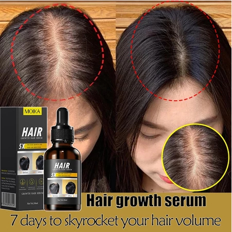 Hair Growth Serum-生发液-Serum penumbuh rambut Baldness treatment Relieves