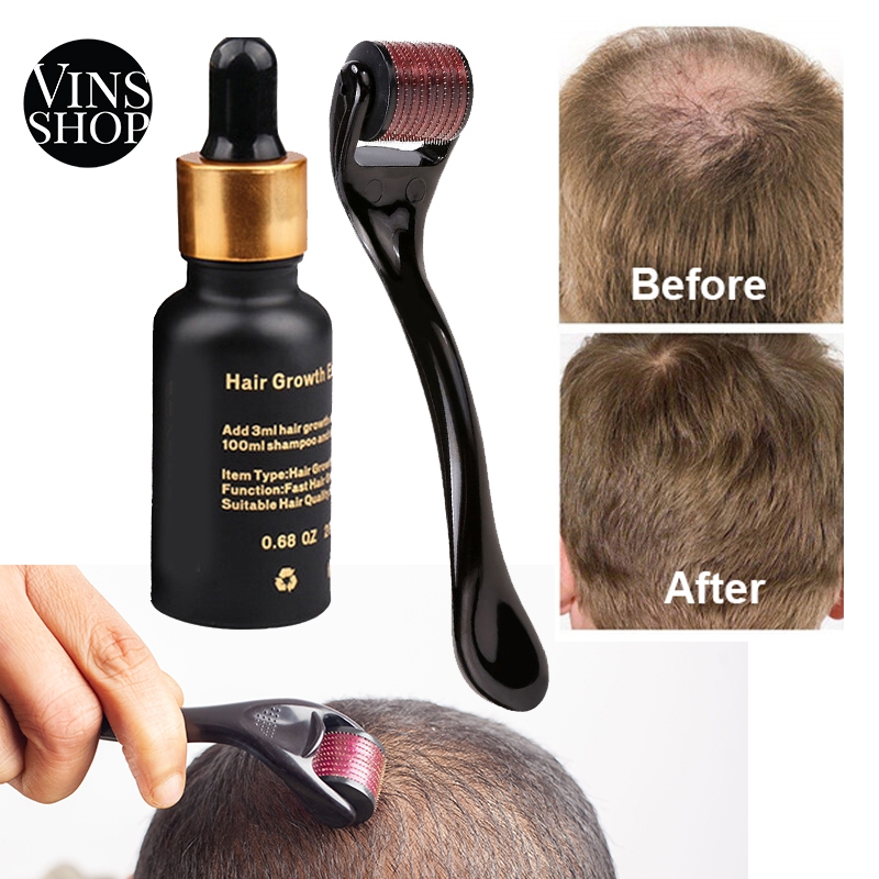 VINS Hair Grow Micro Needle Roller Derma Roller Dermaroller Scalp Hair Growth Anti Hair Loss
