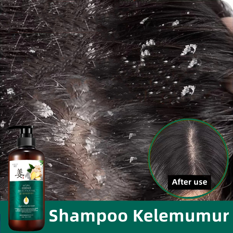 shampoo kelemumur ubat kelemumur kepala scalp treatment dandruff