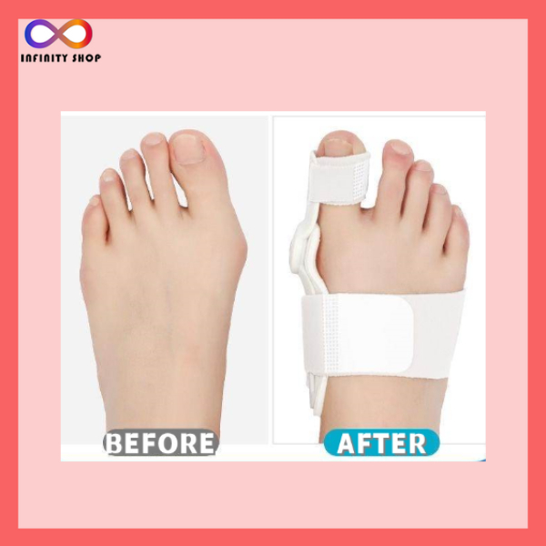 (1pcs) Big Toe Corrector Bunion Aid Splint Hallux Valgus Orthotics Big