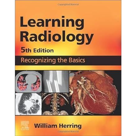 Learning Radiology : Recognizing the Basics 5th ed 2023 | Shopee Malaysia