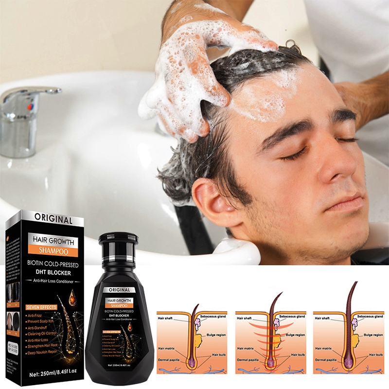 original ginger shampoo rambut gugur hair growth serum anti hair fall ...