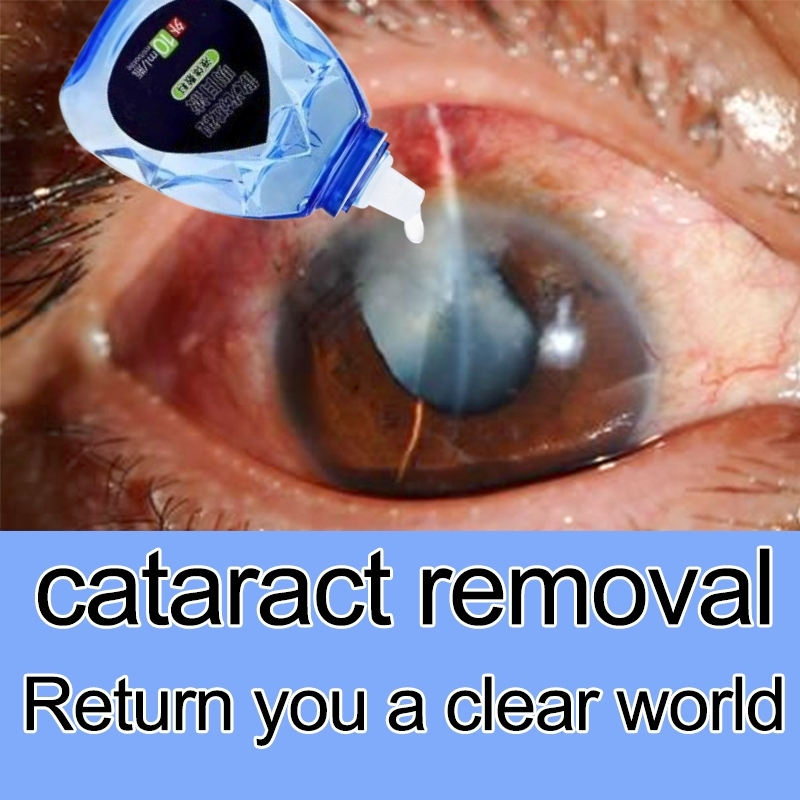 Eye drops for cataract Eye drops for dry eye rawatan mata selaput、mata ...