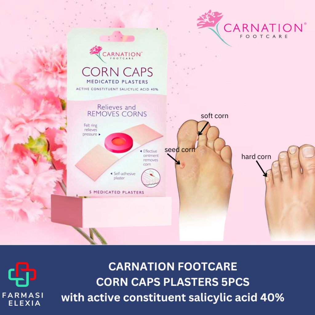 CARNATION CORN CAPS PLASTER 5PCS | Shopee Malaysia