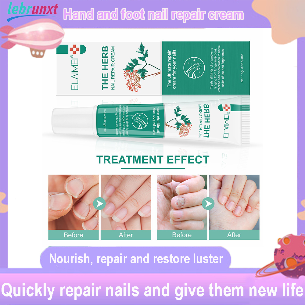 [Malaysian local stock] Hand and foot nail repair cream antifungal