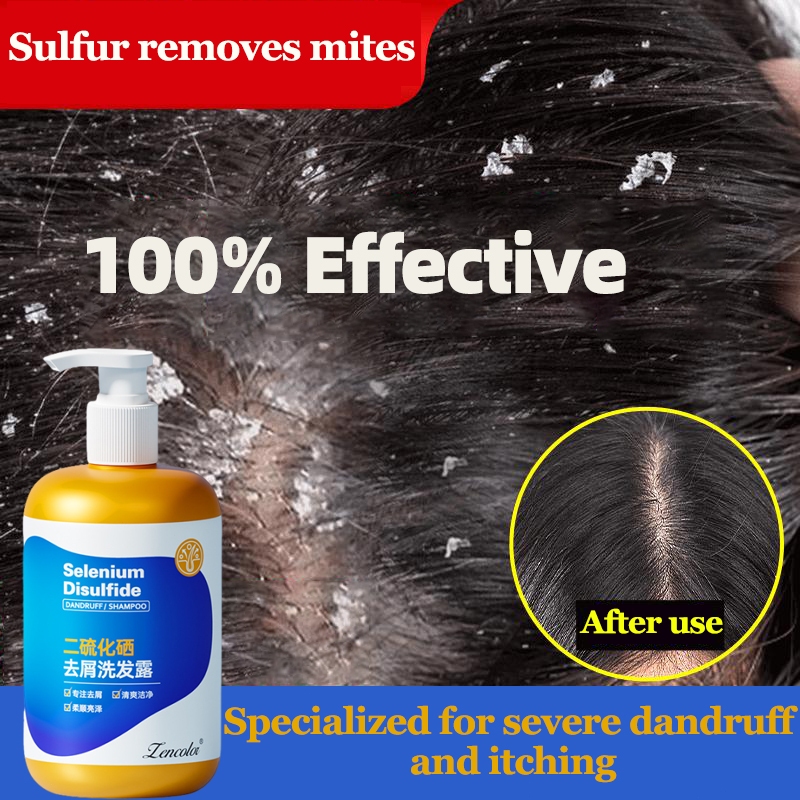 Anti Dandruff Shampoo Syampoo Kelemumur Dan Gatal Kepala 300ml Remove