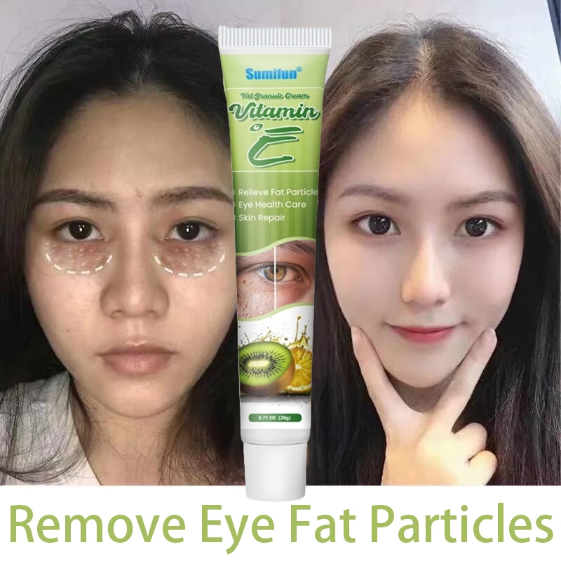 krim milia seed remover vitamin E eye milia cream fat granule syringoma