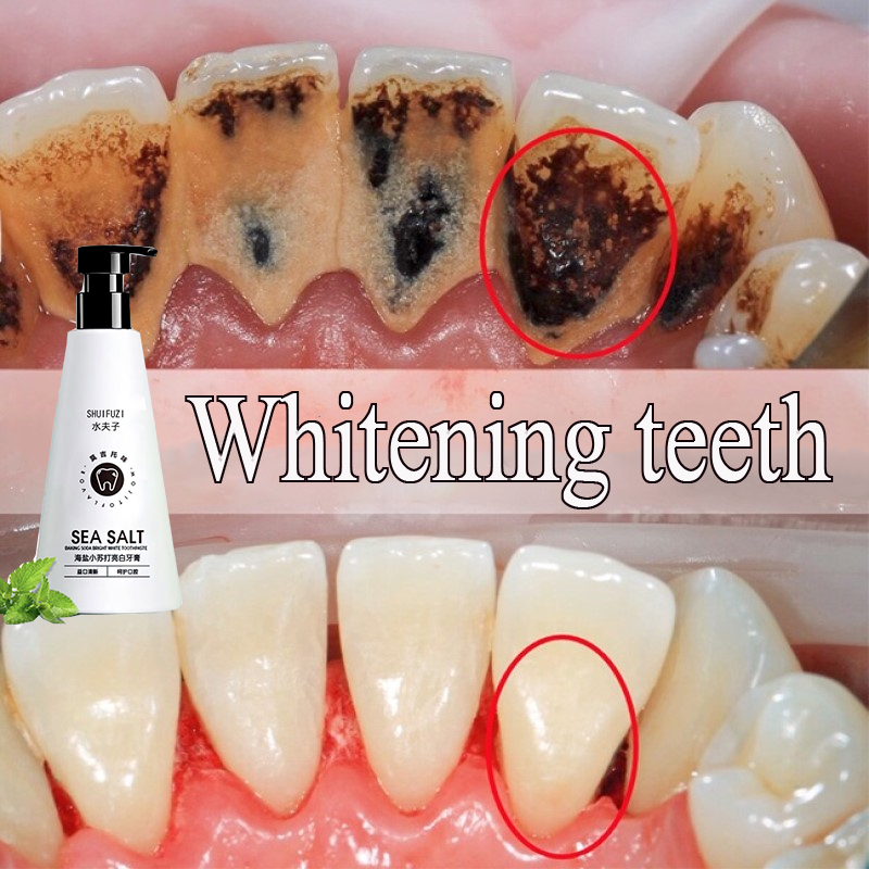 ubat gigi pemutih pemutih gigi kuning tartar remover Bad Breath Smoke Stains tiktok Sea Salt