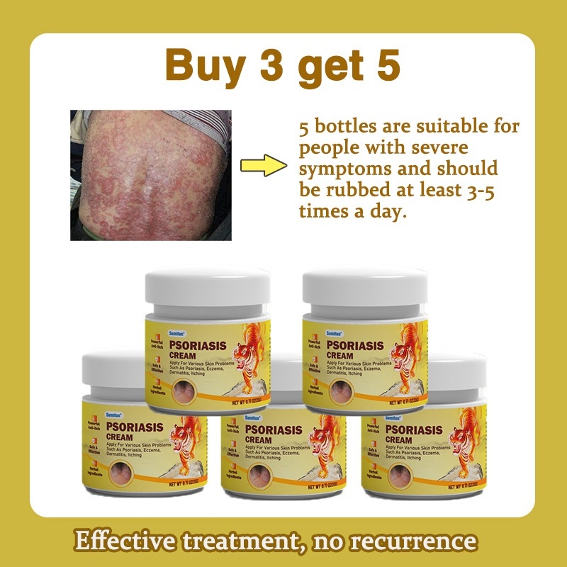 Psoriasis Cream Antifungal Cream Eczema Cream Cream Gatal Kulit 20g