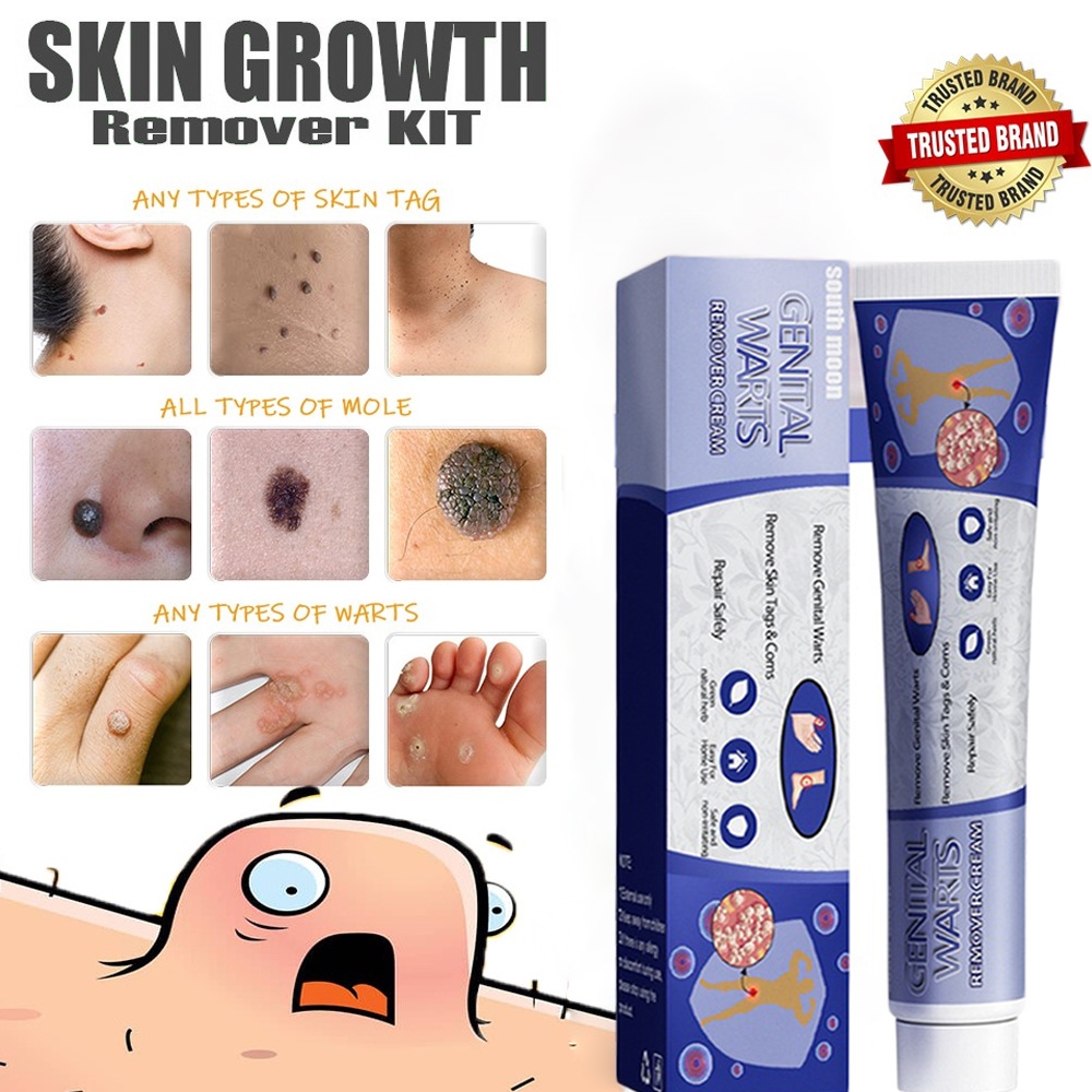 Ubat Buang Kutil Ketuat Tahi Lalat Biji Kolestrol Mole Removal Ointment Warts Skin Tags Remover