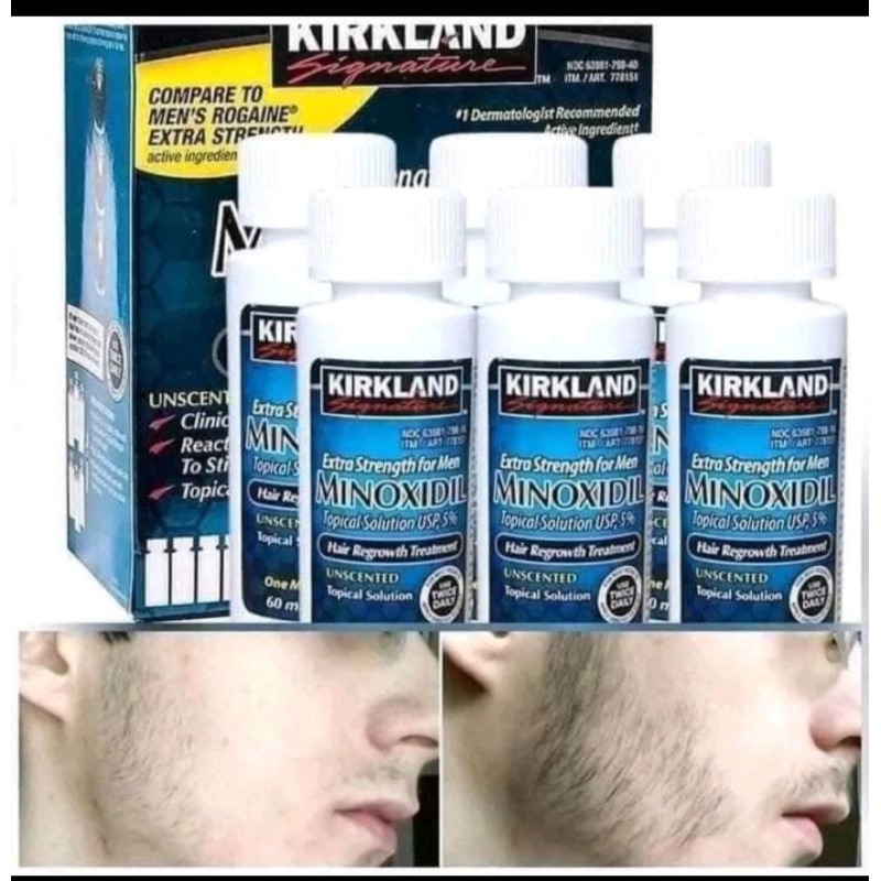 KIRKLAND Hair Growth Spray, Hair Regrowth treatment | Shopee Malaysia