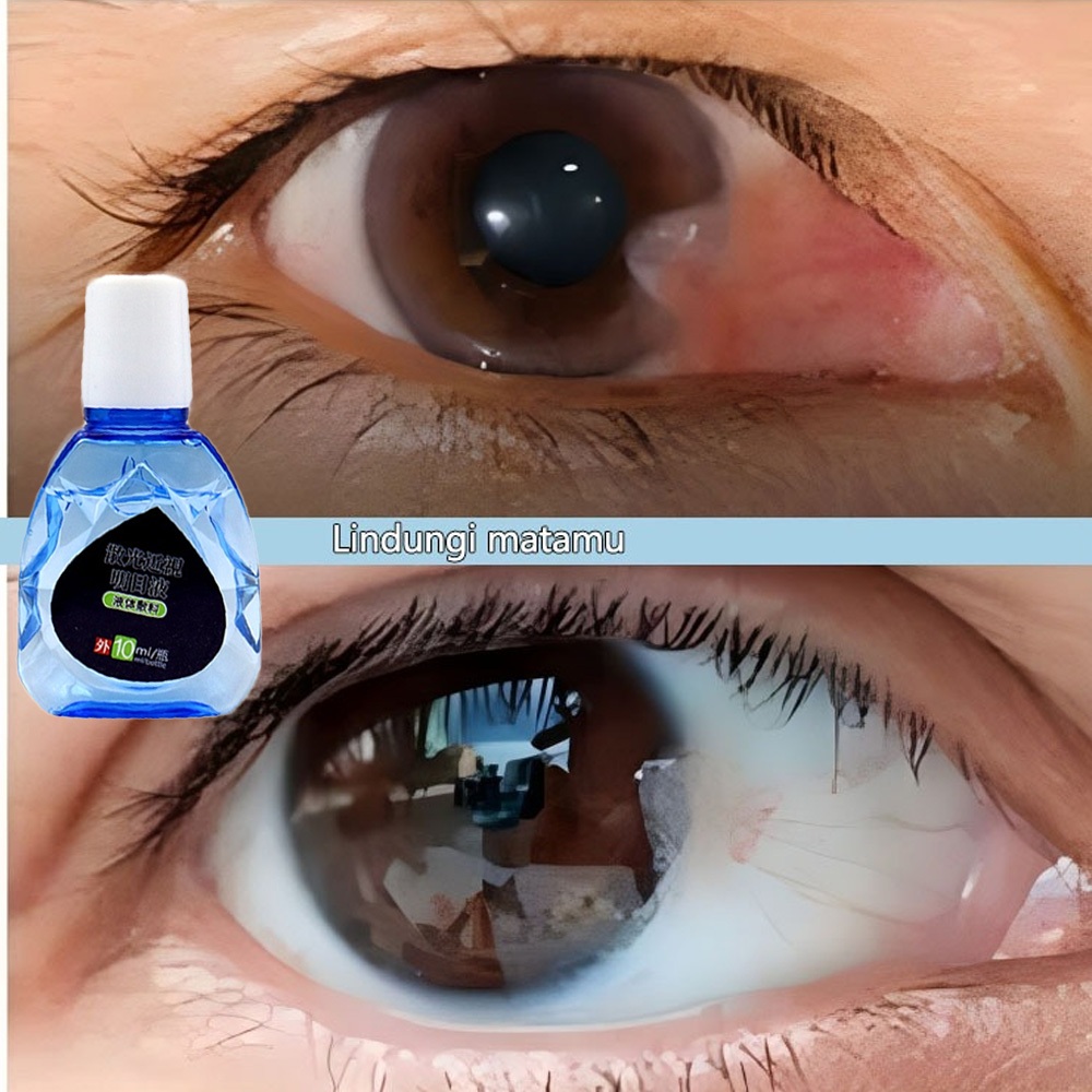 eye drop japan ubat mata ubat titis mata jepun merah ubat selaput mata