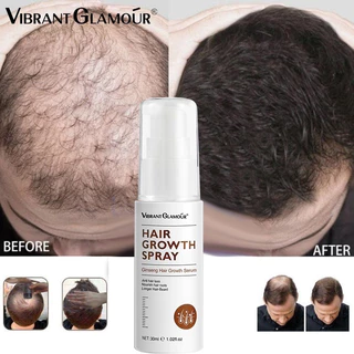 minoxidil hair treatment Malaysia, Best Deals October 2024 | Shopee ...