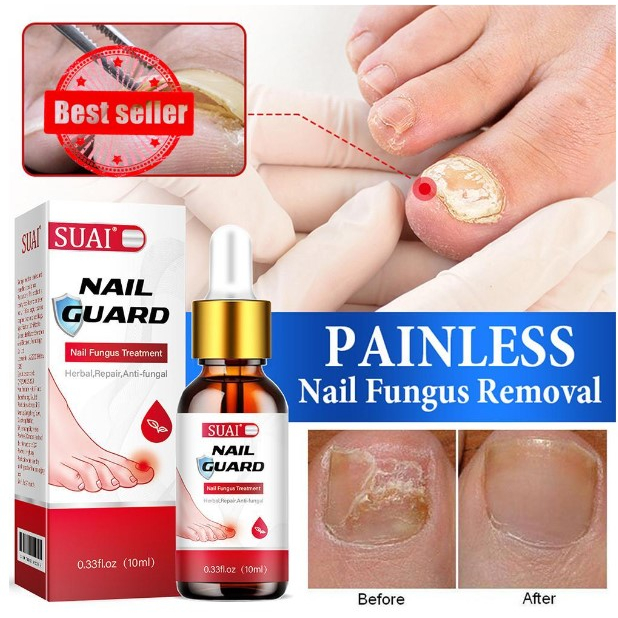 SUAI Nail Fungus Treatment Serum Toe Fungal Repair Care Foot Hand ...