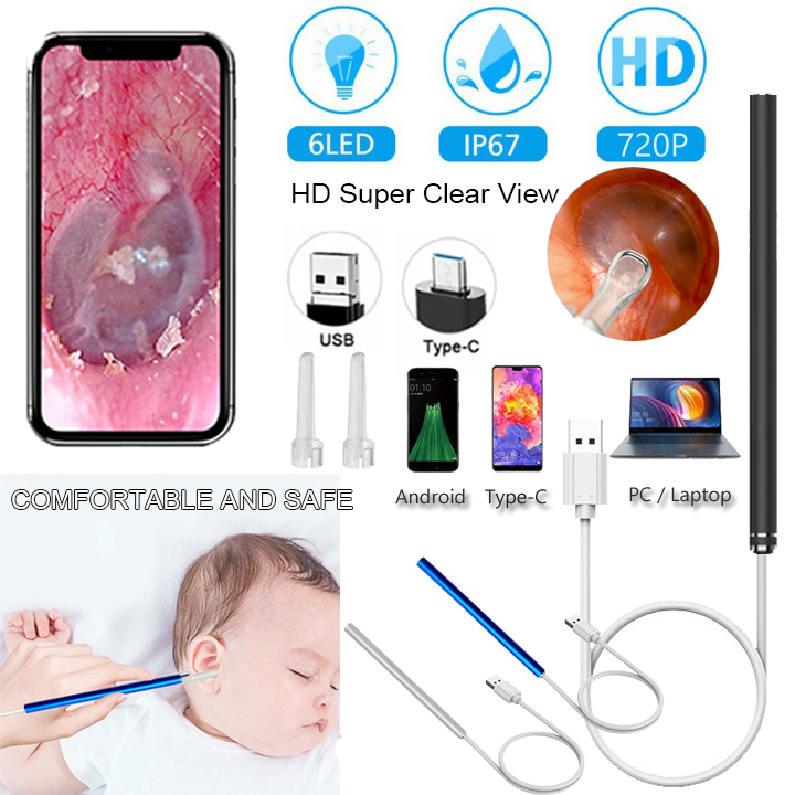 3-in-1 Ear Picker Otoscope Endoscope Spoon Vision Ear Picker Camera 5 ...