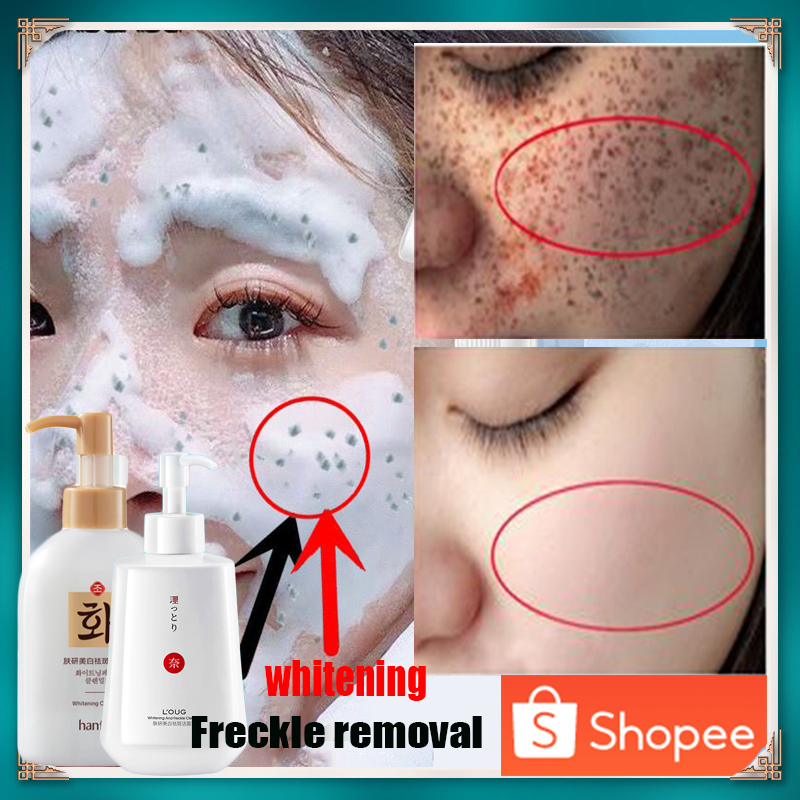 Freckle Cleanser Whitening Face Wash jeragat paling berkesan