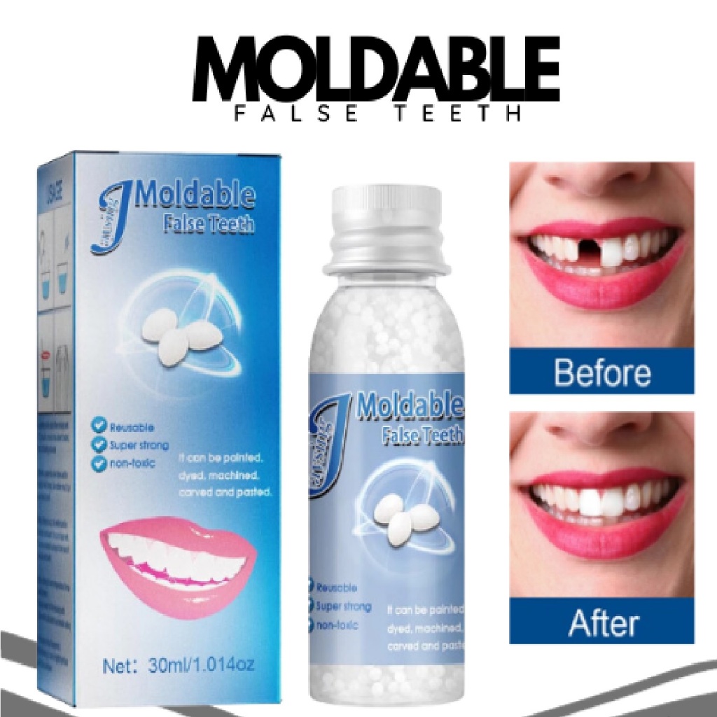 💥💥💥 PROMOSI!!Diy Gigi Palsu Temporary Tooth Repair Kit Teeth And Gaps ...