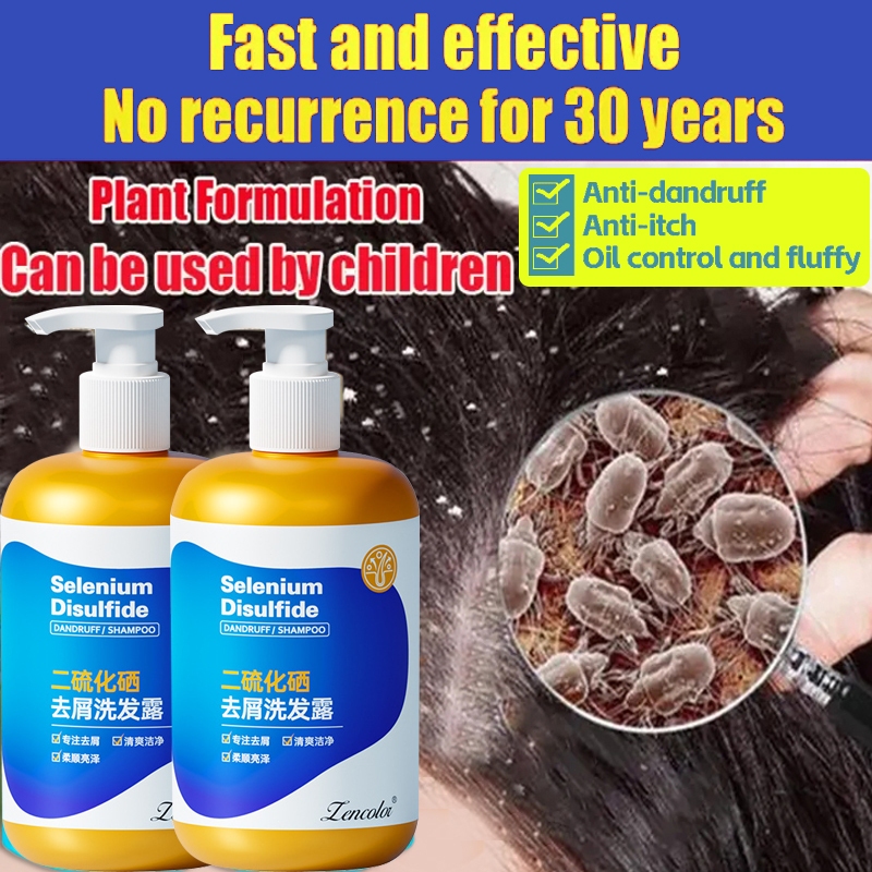 Anti Dandruff Shampoo Shampoo Kelemumur 300ml Relieve Scalp Itching