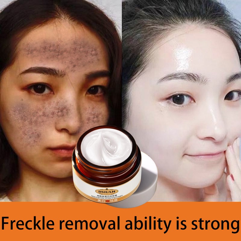 Whitening Freckle Remover Cream 祛斑霜 Pigmentation Remover Cream and Dark