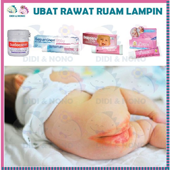 Nappy Rash Cream Bepanthen Sudo Cream Ubat Rawat Ruam Lampin | Shopee ...
