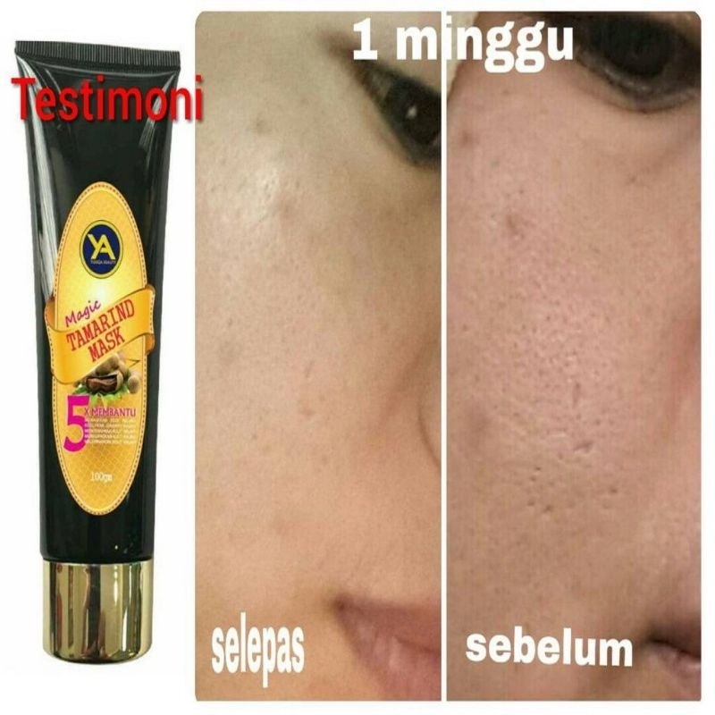 Magic Tamarind Mask Masker Rawat Masalah Muka Kulit Jerawat Parut ...