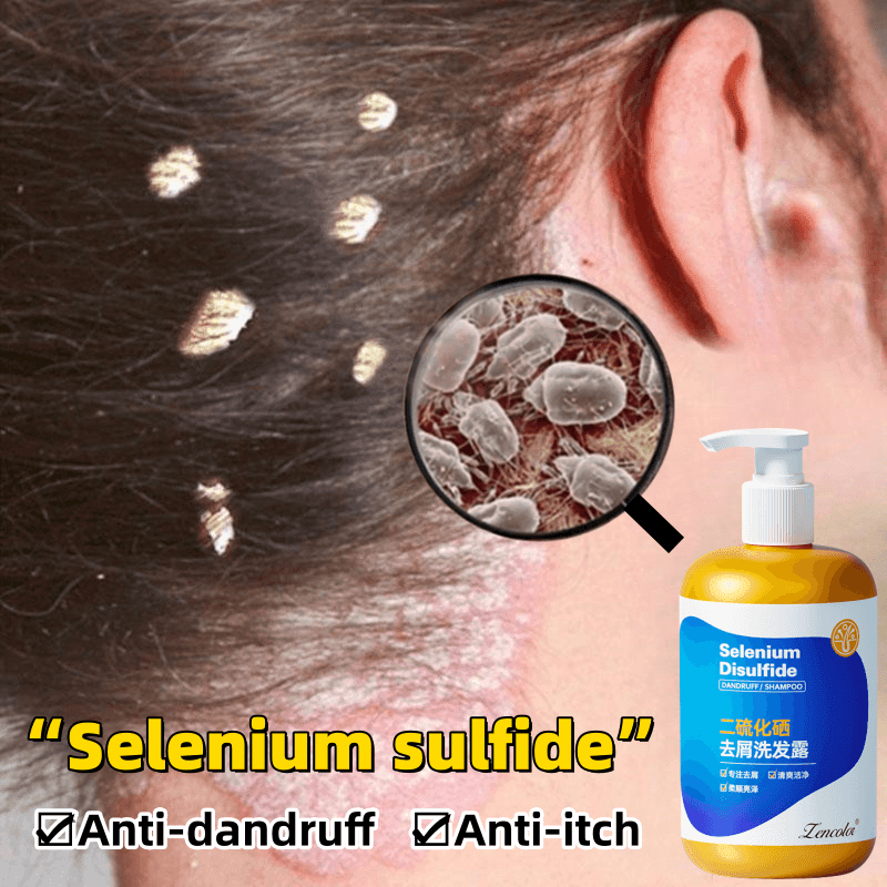 Antidandruff shampooSelenium sulfide shampoo二硫化硒去屑洗发水300ml Anti