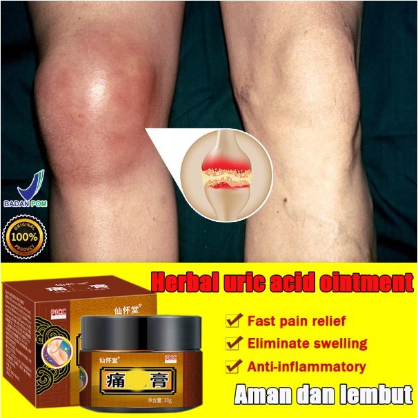Herbal Medicine Gout Ointment joint and bone therapy Jointment cream ...