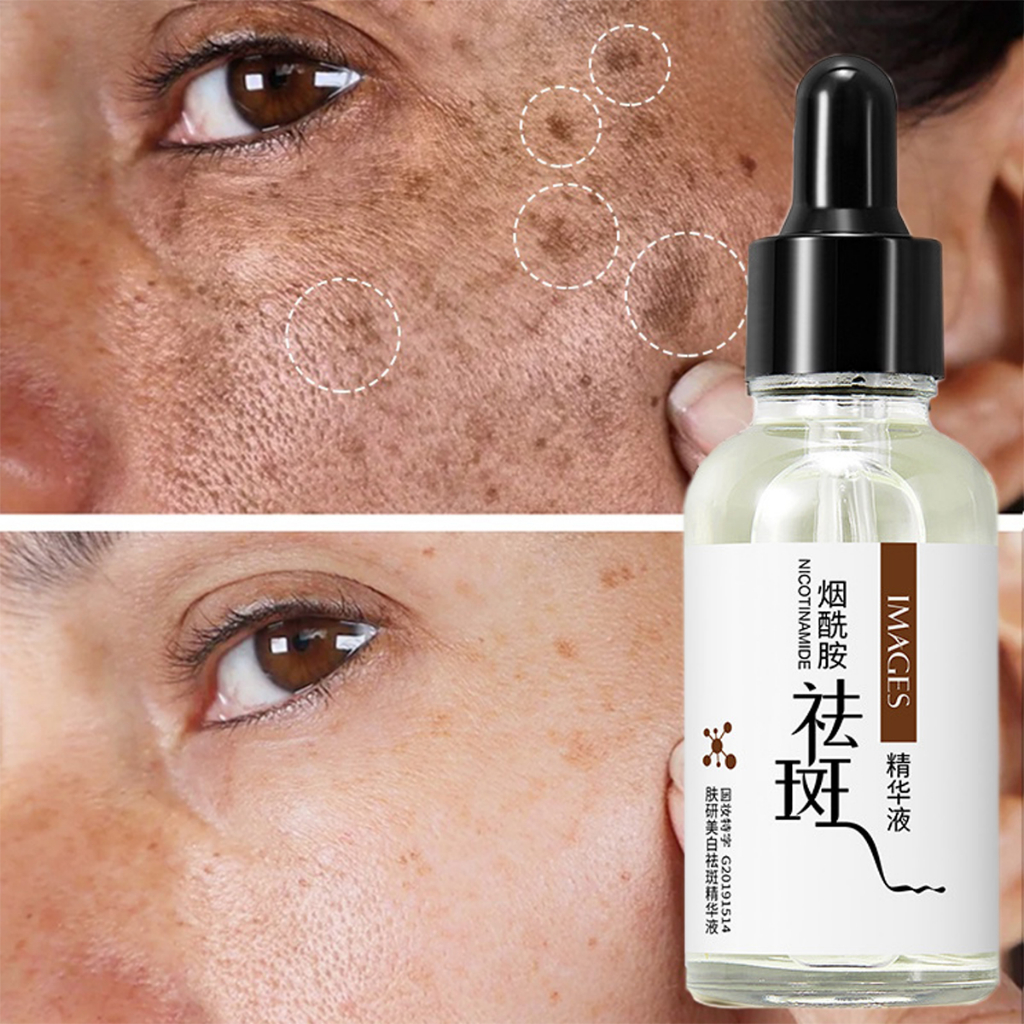 Niacinamide Whitening Serum Facial Essence Dark Spot Freckle Melasma
