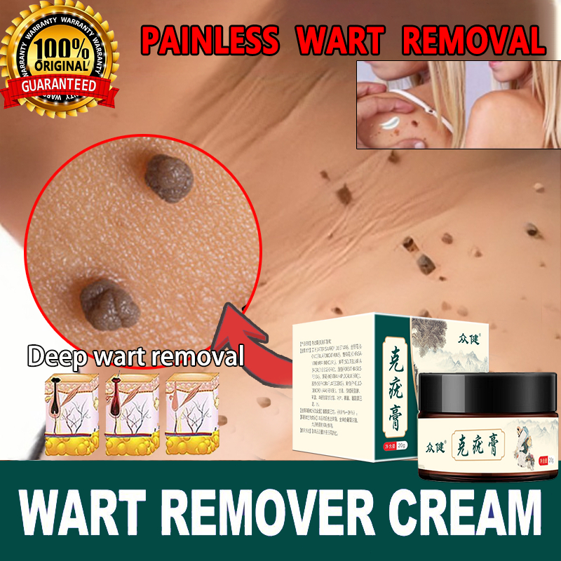 Ubat Buang Kutil Ketuat Tahi Lalat Biji Kolestrol Mole Removal Wart Cream Wart Removal Ointment