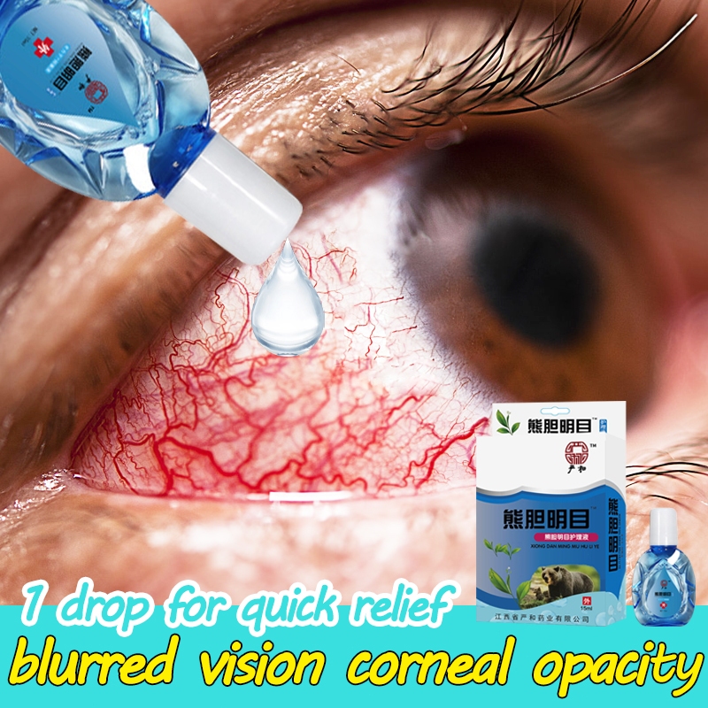 Eye Drops 15ml Quick Relief Blurred Vision Corneal Opacity Dryness ...