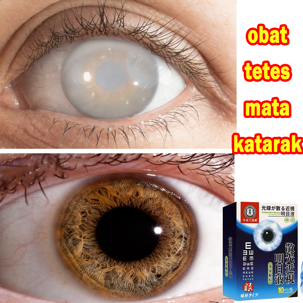 ubat mata katarak eye drop japan cataract eye drop ubat titis mata ...