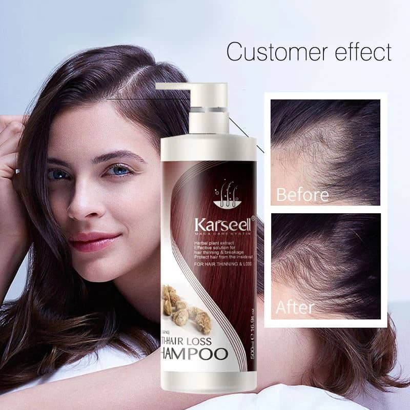 karseell-moisture-hair-shampoo-anti-hair-loss-for-all-hair-repair