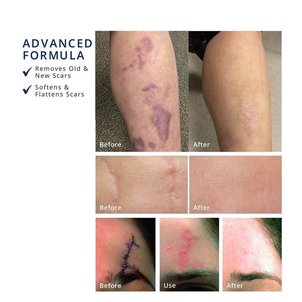 NEW! SKINCARE CREAM PIGMENTATION AND SCAR IMPROVEMENT (Krim hilangkan
