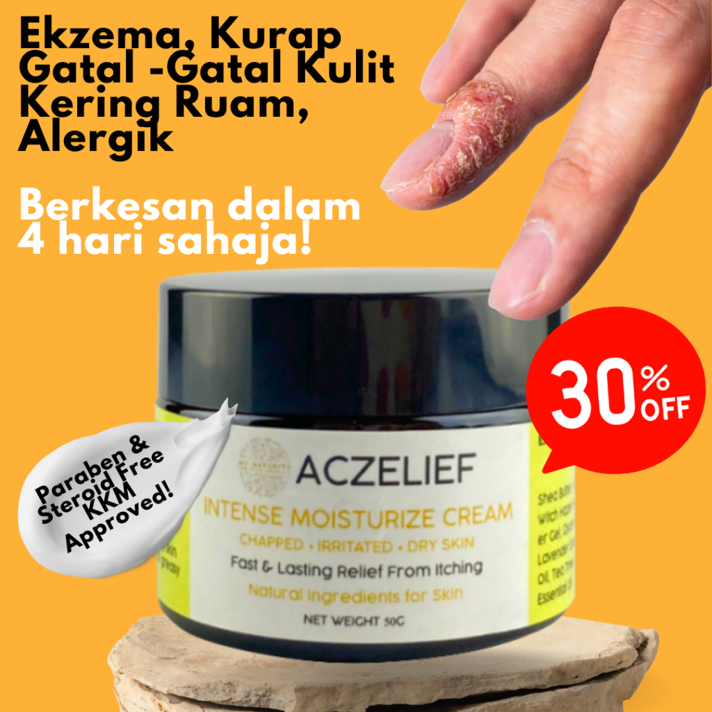 MyNaturity Aczelief Eczema Cream 50g Krim Ekzema Gatal Gatal Kurap