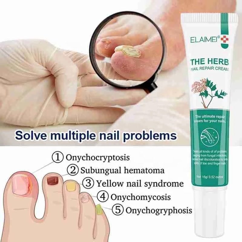 Pure Plant Nail repair Cream 15g Damaged Nourishing nails, anti