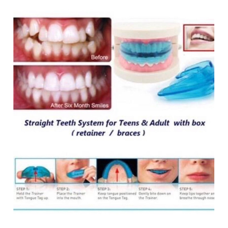 TEETH TRAINER Cantikkan gigi senget berlapis jonggang bertindih tidak ...