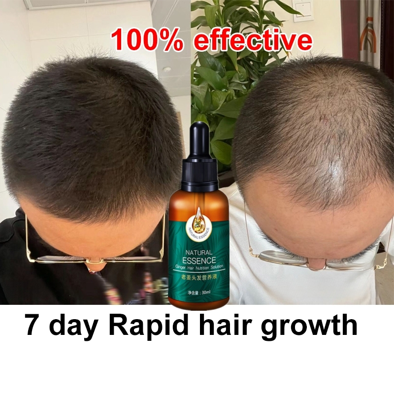 Fast Hair Growth Serum rambut gugur serum Ginger hair growth oil Hair ...