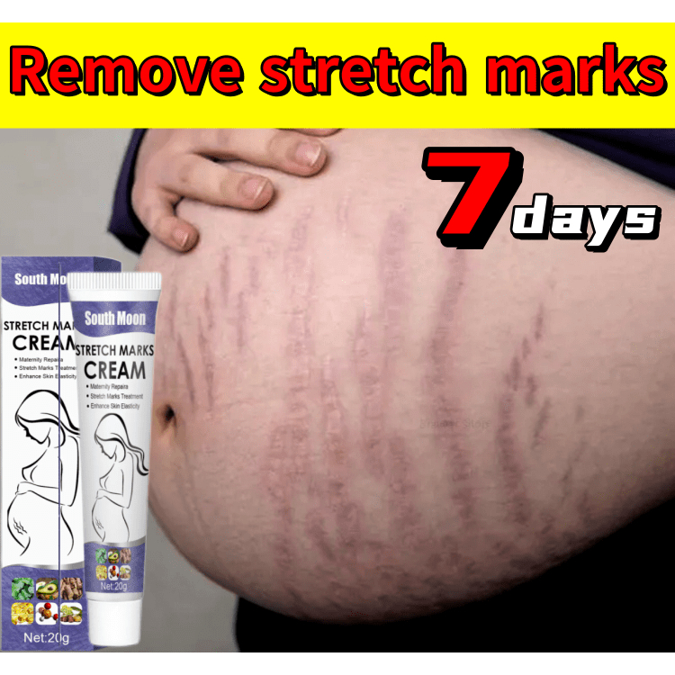 Stretchmark Remover Cream Anti Stretch Mark Cream Effectively Remove Postpartum Stretch Marks 4404