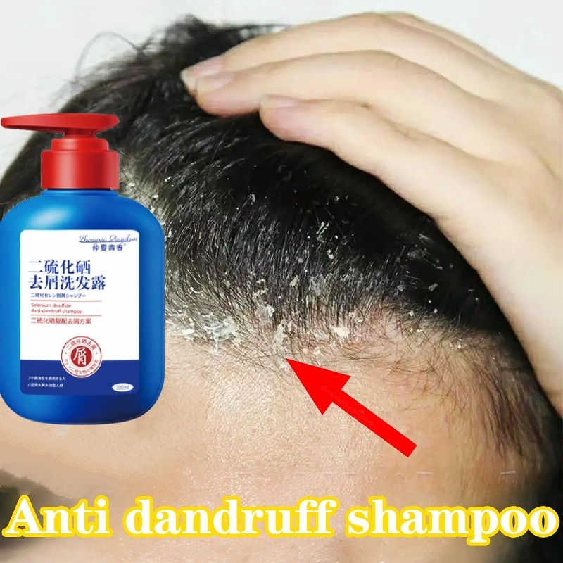 Selenium Sulfide Anti Dandruff Shampoo Kelemumur Treatment Dandruff