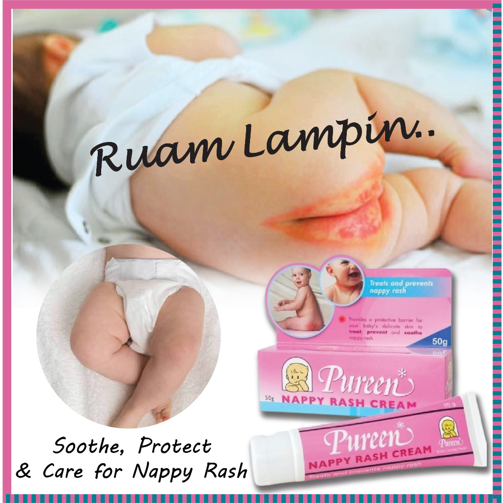 Pureen Nappy Rash Cream 50g - Krim Ruam Bayi | Shopee Malaysia