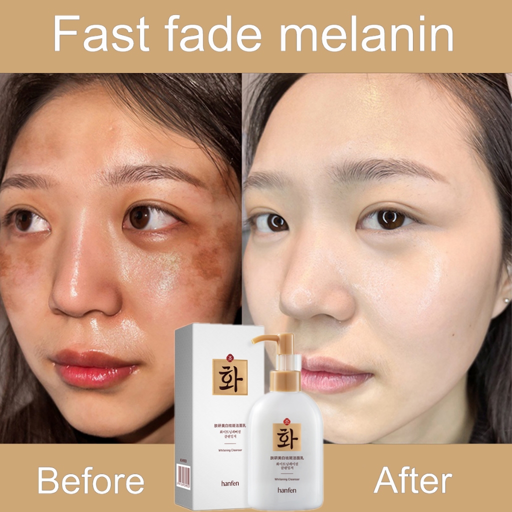 Whitening Freckle Cleanser krim jeragat paling berkesan treatment